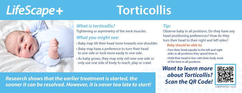 Torticollis Information